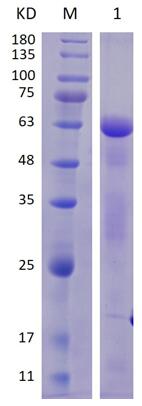 12% SDS-PAGE analysis profiles of purified KP1_1632-23-597 (CBB stained).